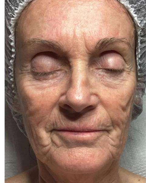 Before: A firmer, more toned-looking face